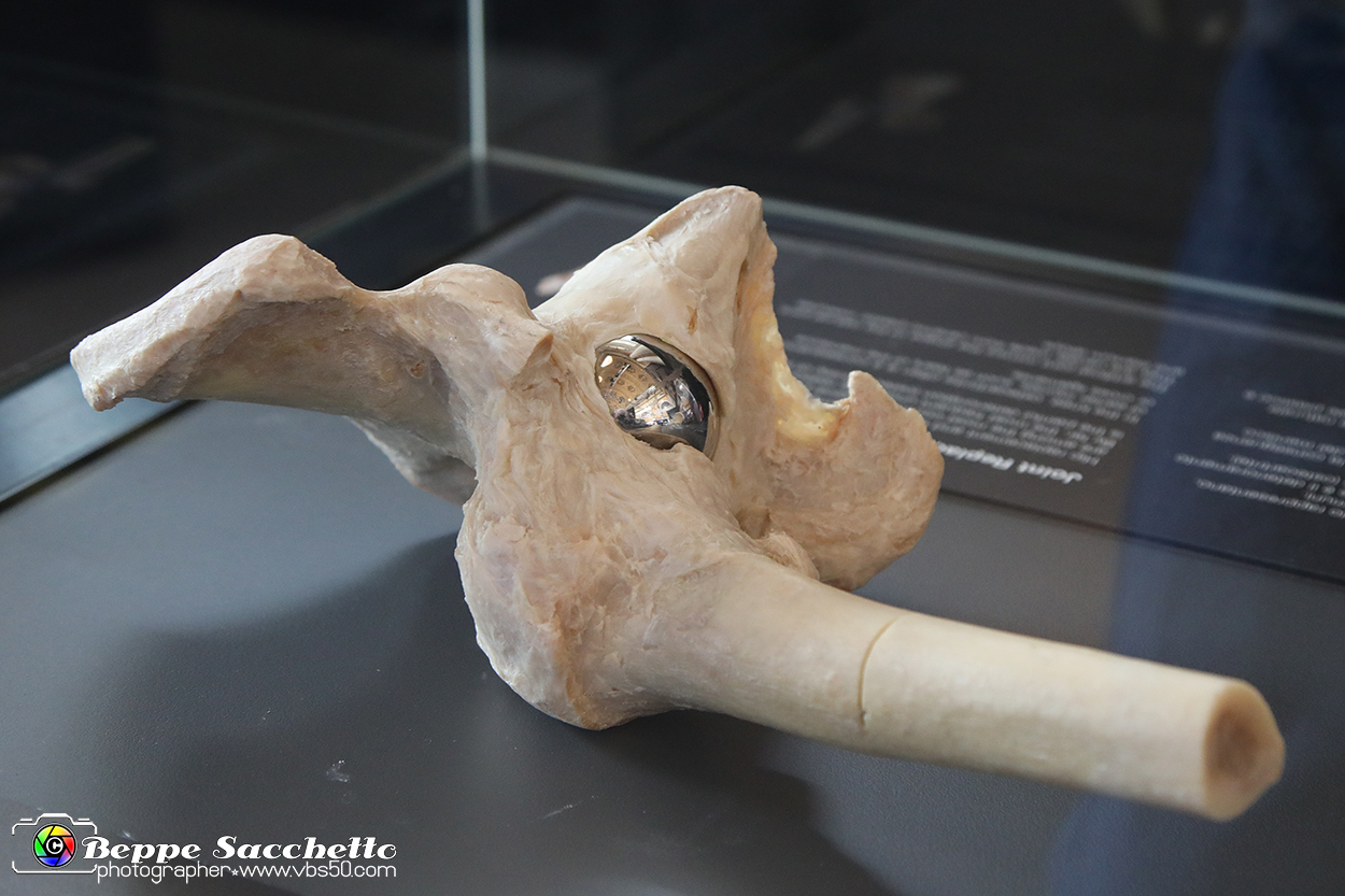 VBS_3065 - Protesi articolare - Mostra Body Worlds.jpg